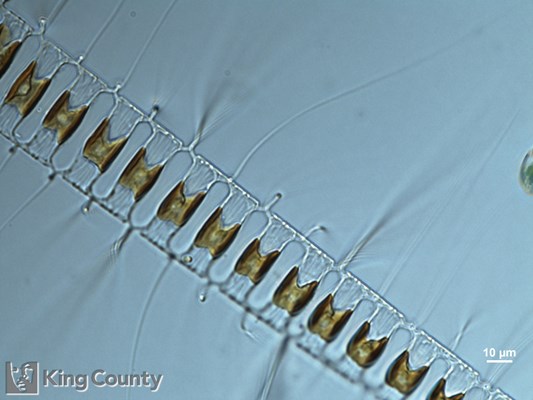 Photo of Chaetoceros diadema